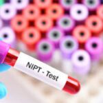 Η Αξία του Μη Επεμβατικού Προγεννητικού Ελέγχου