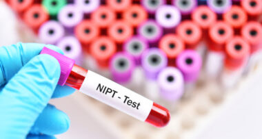 Η Αξία του Μη Επεμβατικού Προγεννητικού Ελέγχου